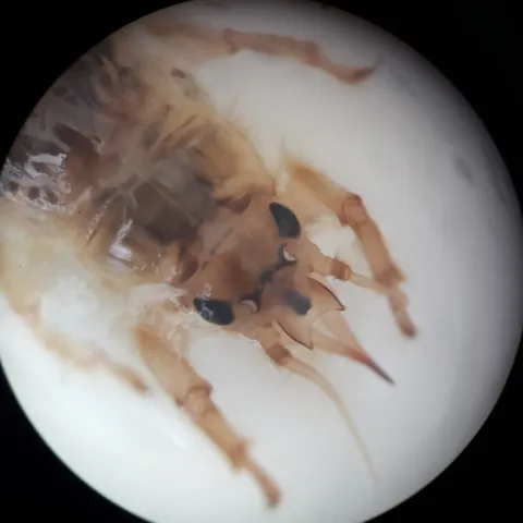 Nahaufnahme einer Kopflaus unter dem Mikroskop.